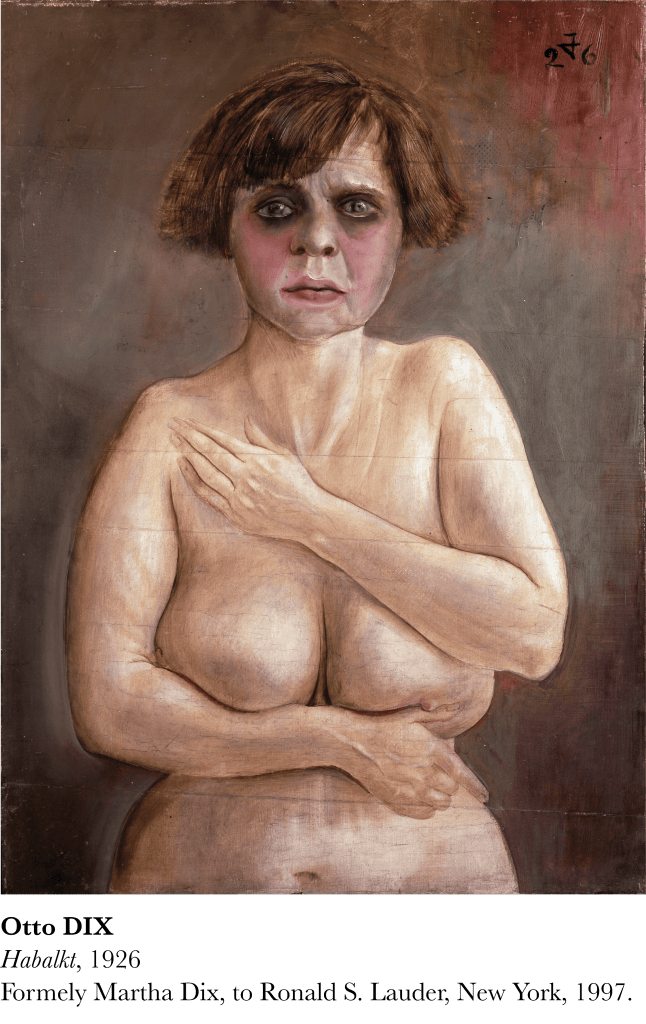 Chef-d'œuvre de la Nouvelle Objectivité (Neue Sachlichkeit) par Otto Dix (1926). Un portrait sans fard, expression brute du réalisme et du vérisme de l'entre-deux-guerres.
